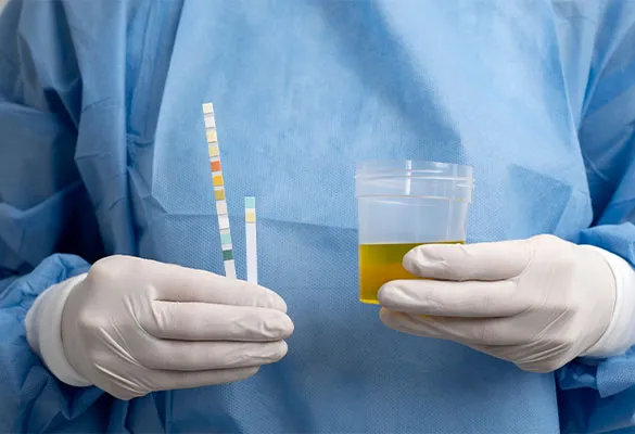 medico com amostra de urina e um medidor de ph