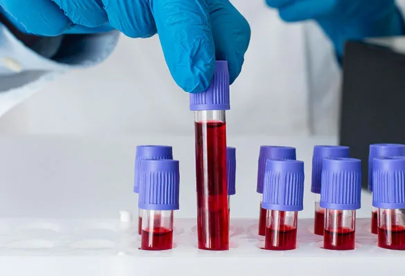 tubos com sangue para analise